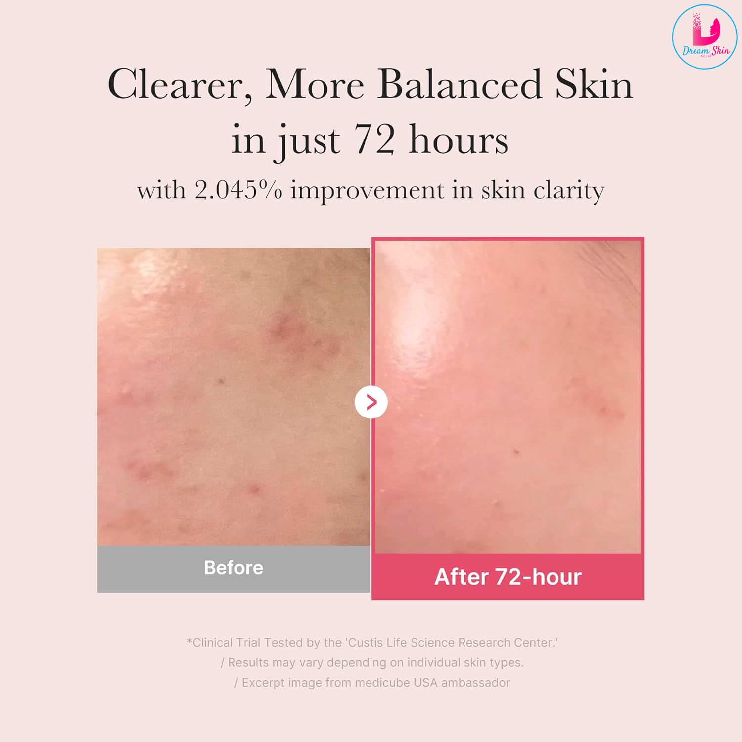 Medicube TXA+Niacinamide 15% Serum [30ml] 